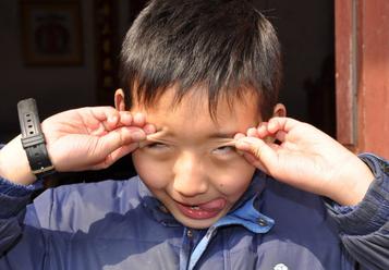 择思达斯_小孩子头部总是抽动是怎么回事如何治疗