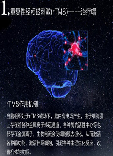 经颅磁刺激治疗儿童多动症疗效